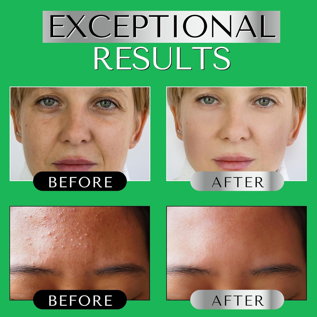 SERUM RETINOL ALTA POTENCIA Con Vitamina E, Acido Hialuronico Y Aceite De Jojoba Para La Cara - Serum Facial Antimanchas, Antiarrugas Y Antiedad - Suero Hidratante Y Despigmentante Facial – DERMAWORKS