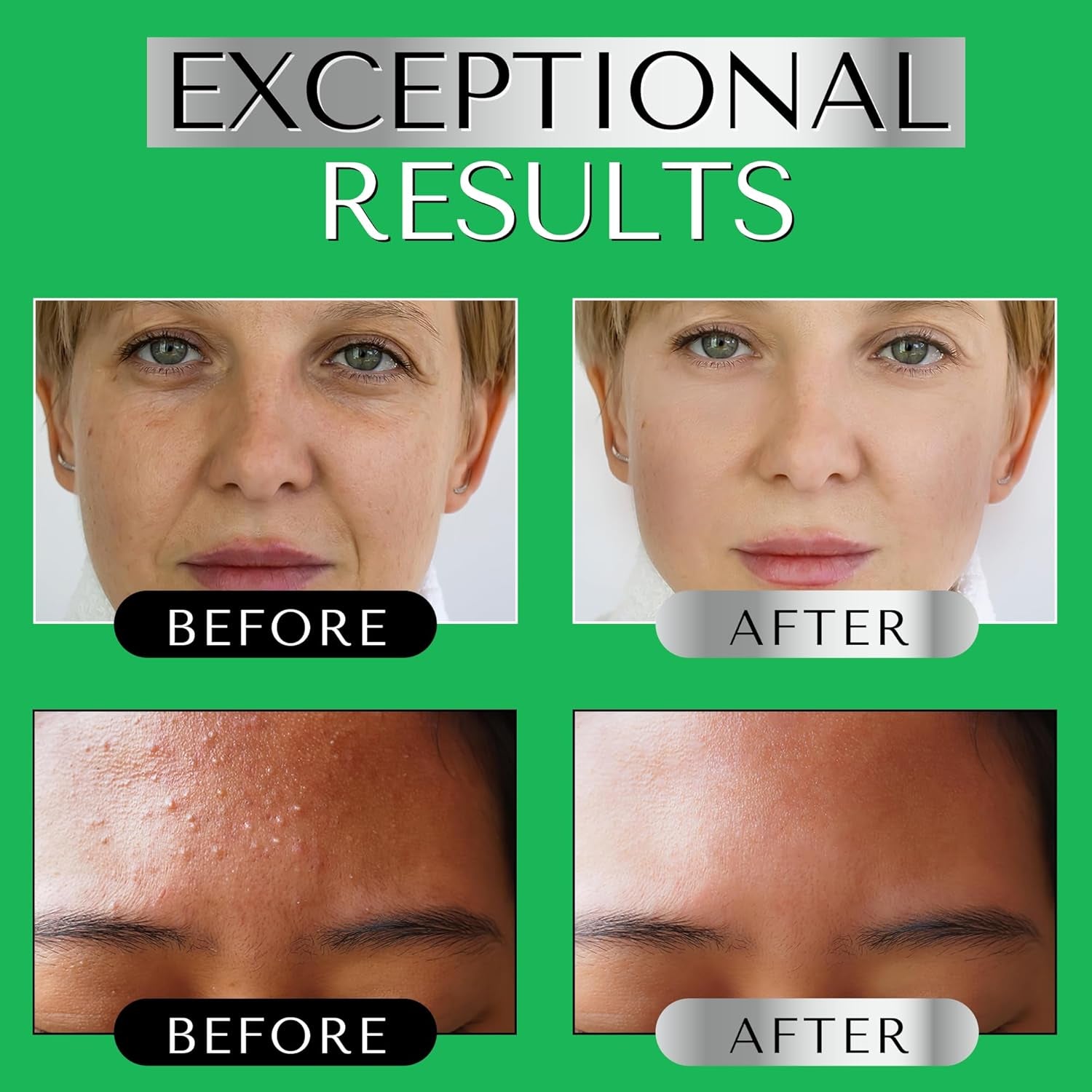 SERUM RETINOL ALTA POTENCIA Con Vitamina E, Acido Hialuronico Y Aceite De Jojoba Para La Cara - Serum Facial Antimanchas, Antiarrugas Y Antiedad - Suero Hidratante Y Despigmentante Facial – DERMAWORKS